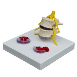 Skelet Hernia-model